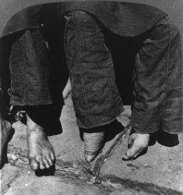 Natural vs. Bound Feet (1902), Photo by G. G. Bain, Library of Congress